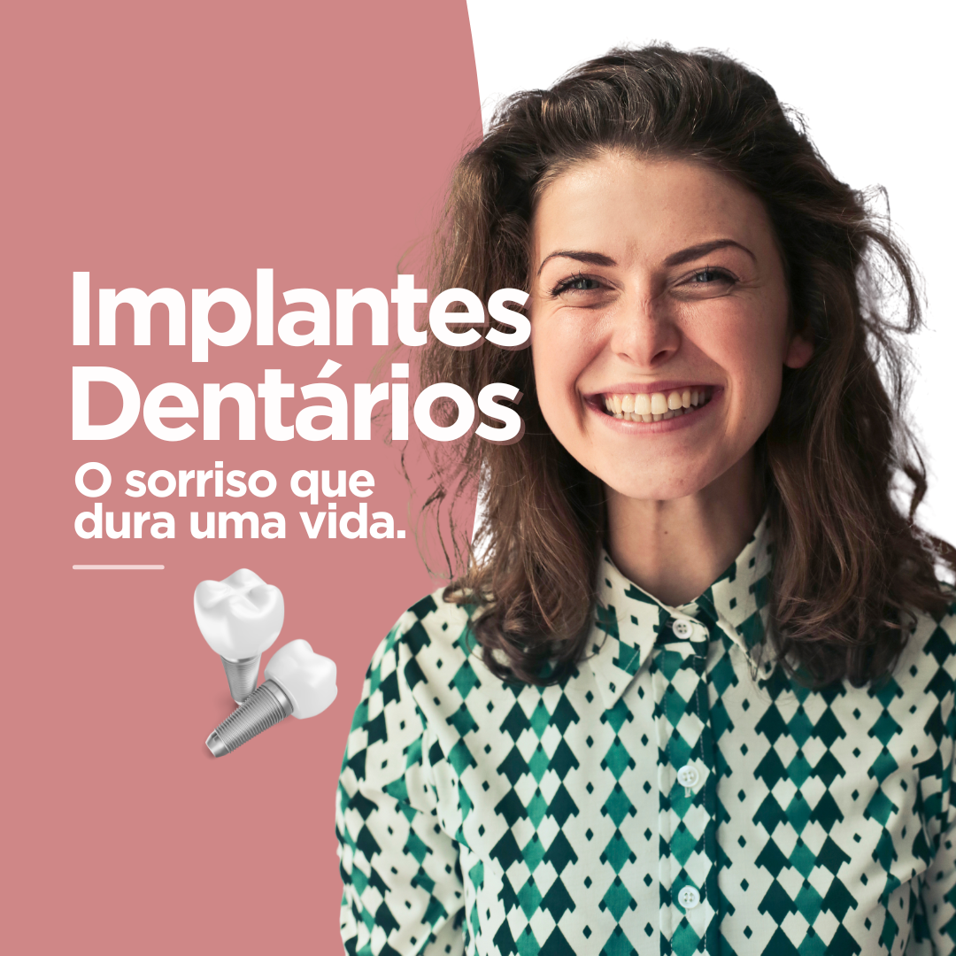 implantes dentarios