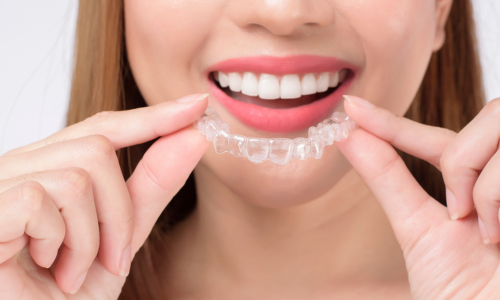 invisalign
