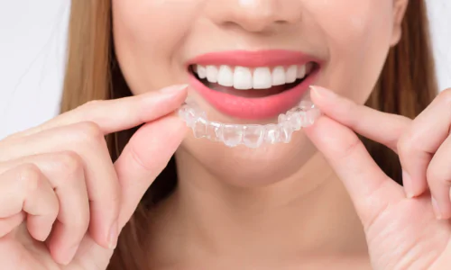 invisalign